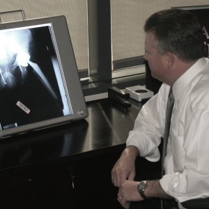 Defective Hip Knee Implants Zimmer Biomet Zimmer Biomet implant knee replacement failure lawsuit hip replacement lawsuit lawsuit