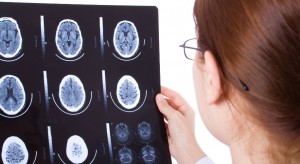 Traumatic Brain Injury x-ray