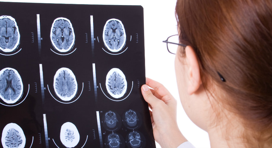 Have You Suffered a Traumatic Brain Injury?