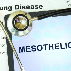 asbestos exposure mesothelioma lawsuit mesothelioma mesothelioma lawyers Asbestos Lawsuits