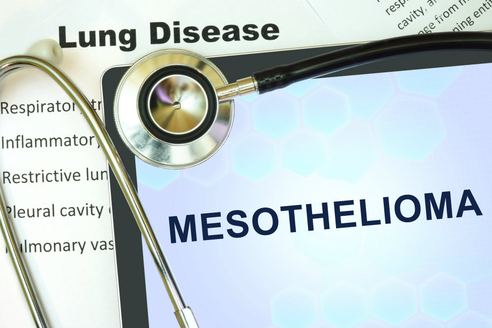 Mesothelioma & Asbestos Lawsuits » Nash and Franciskato Law Firm